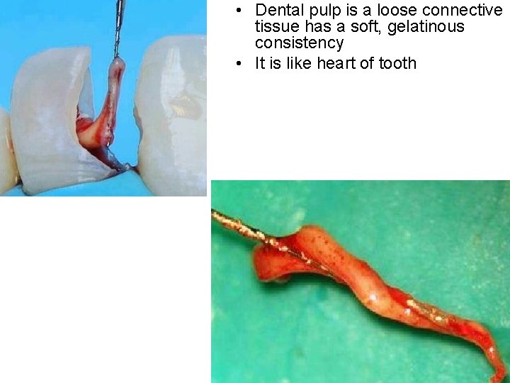  • Dental pulp is a loose connective tissue has a soft, gelatinous consistency