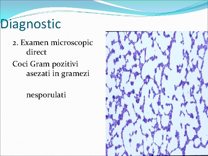 Diagnostic 2. Examen microscopic direct Coci Gram pozitivi asezati in gramezi nesporulati 