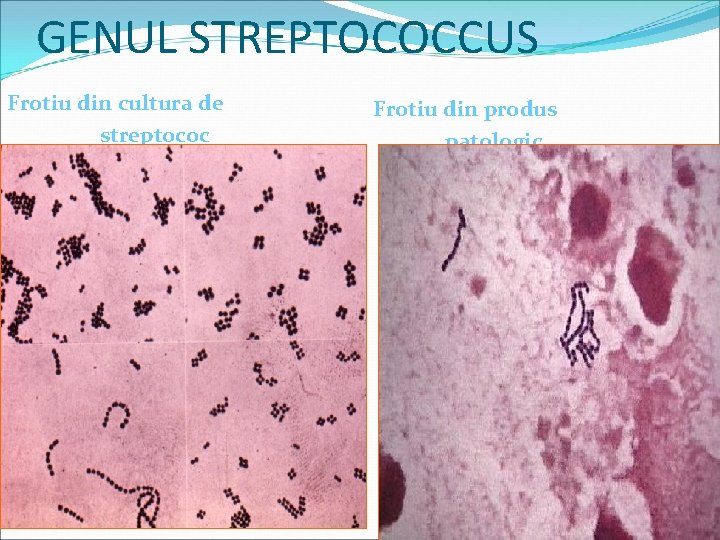 GENUL STREPTOCOCCUS Frotiu din cultura de streptococ Frotiu din produs patologic 