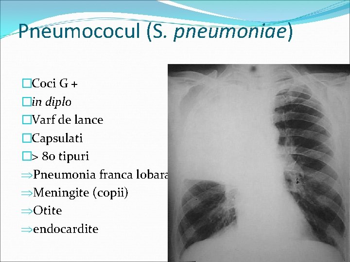 Pneumococul (S. pneumoniae) �Coci G + �in diplo �Varf de lance �Capsulati �> 80