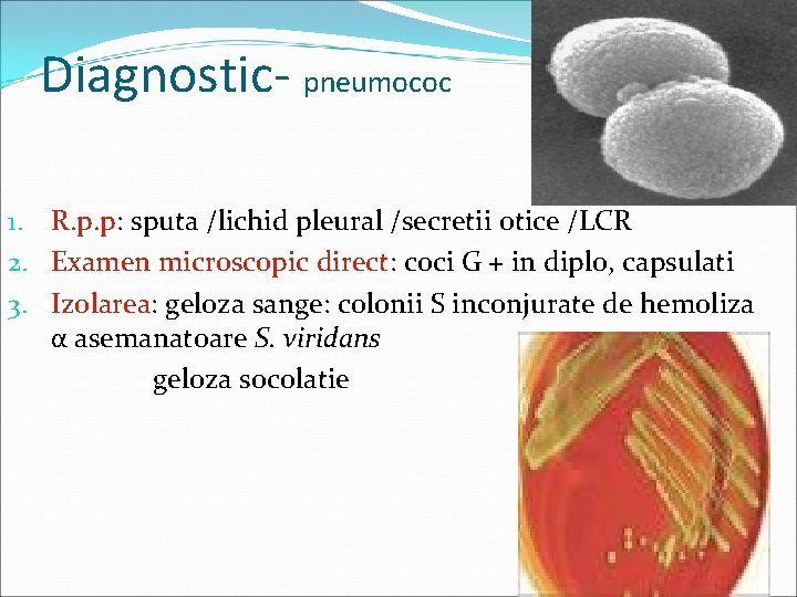 Diagnostic- pneumococ 1. R. p. p: sputa /lichid pleural /secretii otice /LCR 2. Examen