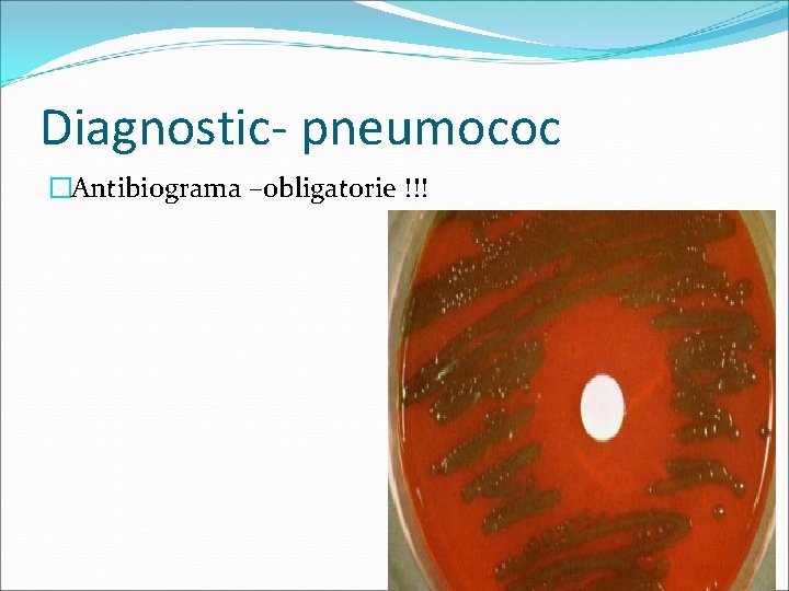 Diagnostic- pneumococ �Antibiograma –obligatorie !!! 