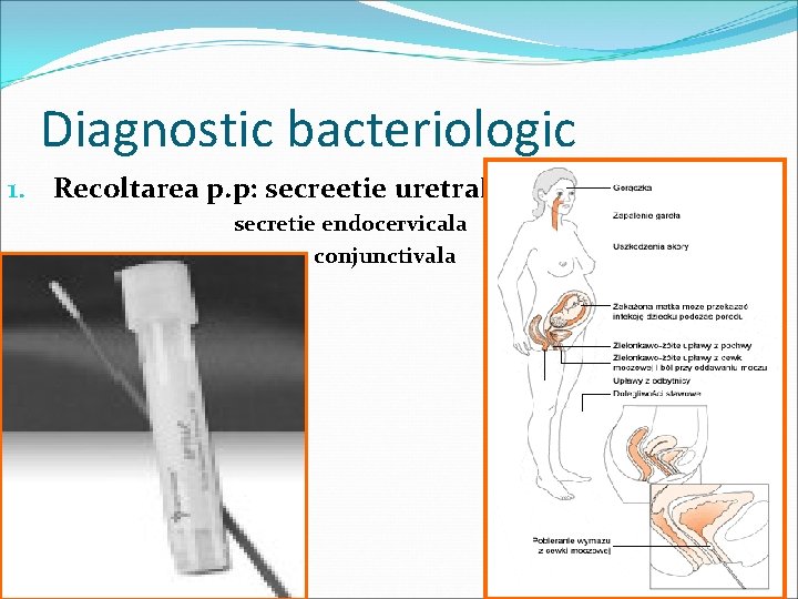 Secretie uretrala -examen bacteriologic | LOTUS-MED