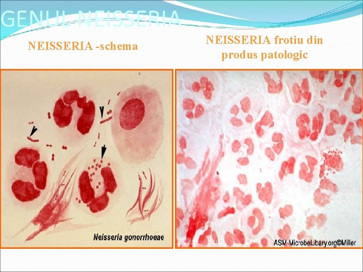 GENUL NEISSERIA -schema NEISSERIA frotiu din produs patologic 