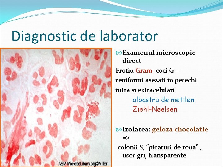 Diagnostic de laborator Examenul microscopic direct Frotiu Gram: coci G – reniformi asezati in