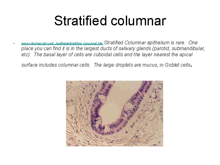 Stratified columnar • Stratified Columnar epithelium is rare. One place you can find it