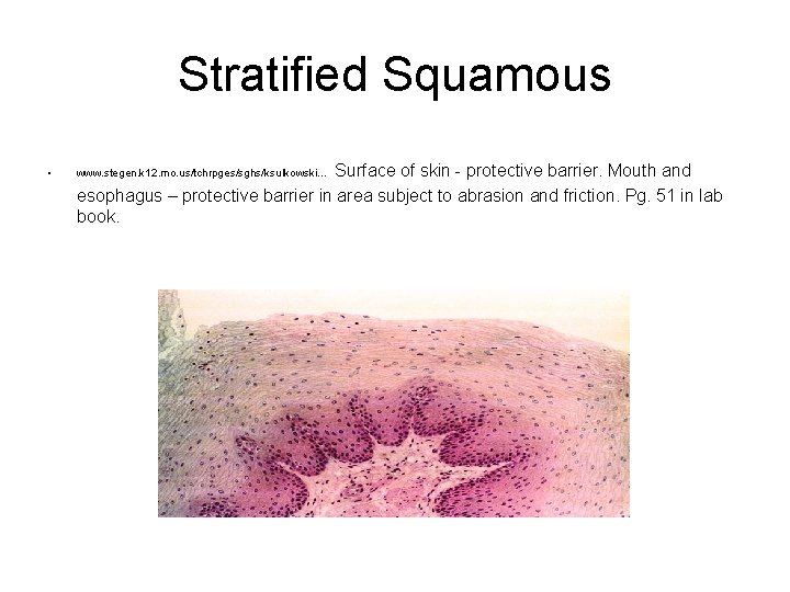 Stratified Squamous • Surface of skin - protective barrier. Mouth and esophagus – protective