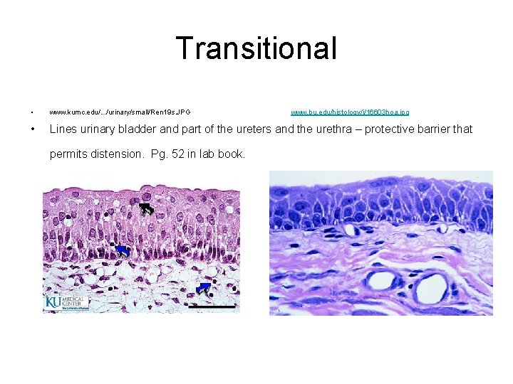 Transitional • www. kumc. edu/. . . /urinary/small/Ren 19 s. JPG • Lines urinary