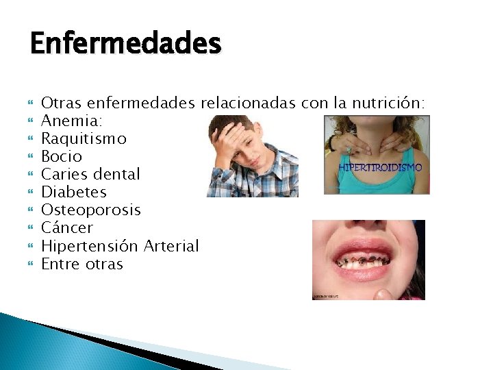 Enfermedades Otras enfermedades relacionadas con la nutrición: Anemia: Raquitismo Bocio Caries dental Diabetes Osteoporosis