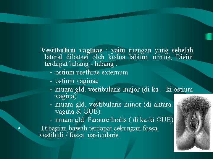 . Vestibulum • vaginae : yaitu ruangan yang sebelah lateral dibatasi oleh kedua labium