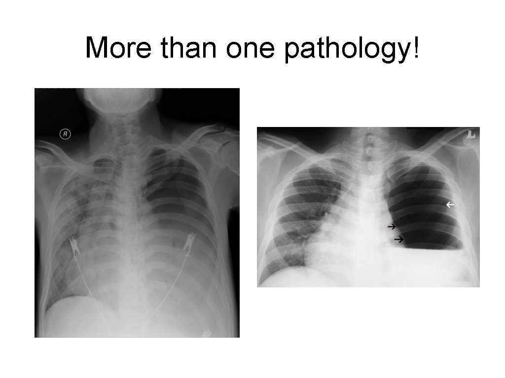 More than one pathology! 