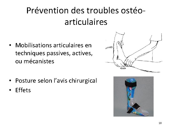 Prévention des troubles ostéoarticulaires • Mobilisations articulaires en techniques passives, actives, ou mécanistes •