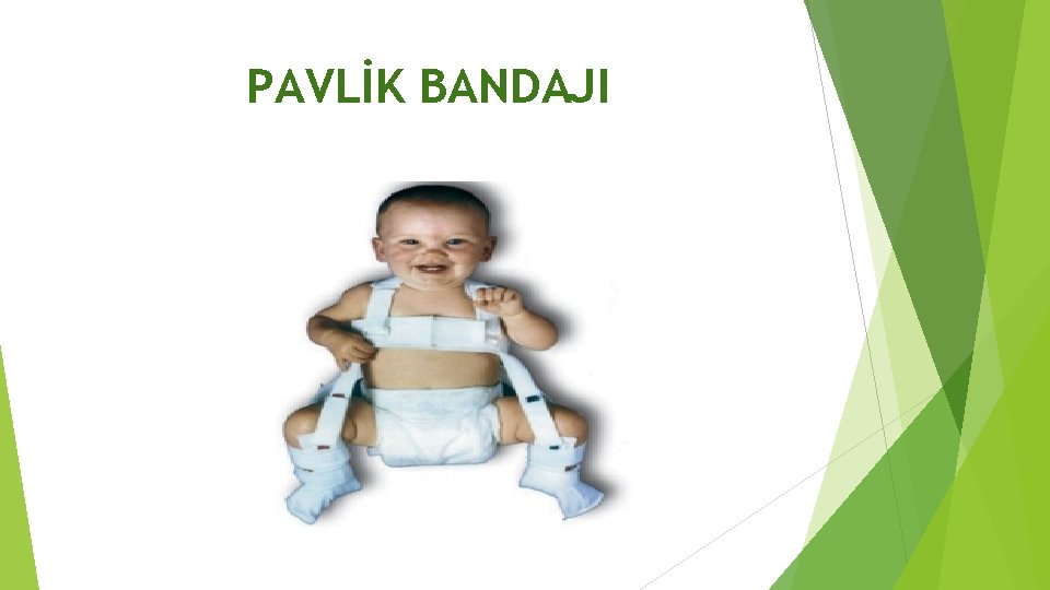 PAVLİK BANDAJI 