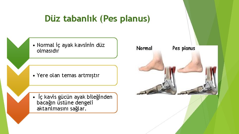 Düz tabanlık (Pes planus) • Normal iç ayak kavsinin düz olmasıdır • Yere olan