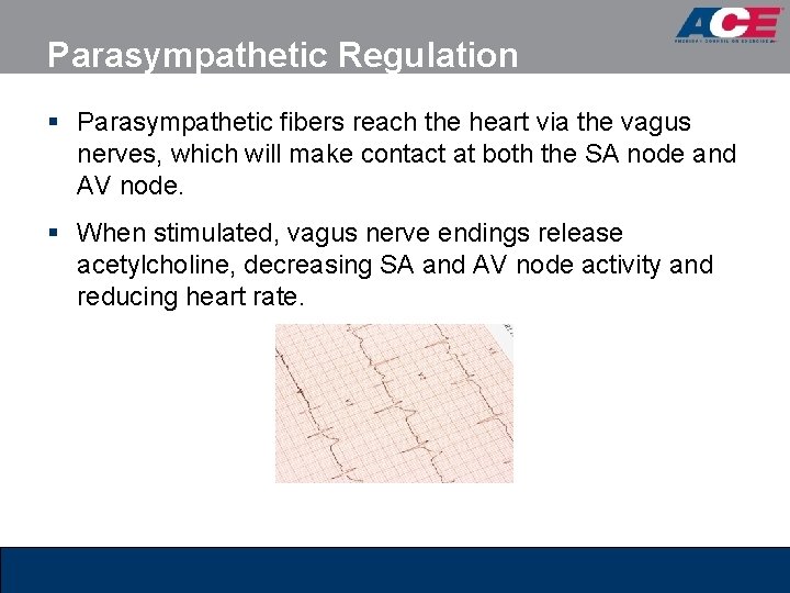 Parasympathetic Regulation § Parasympathetic fibers reach the heart via the vagus nerves, which will