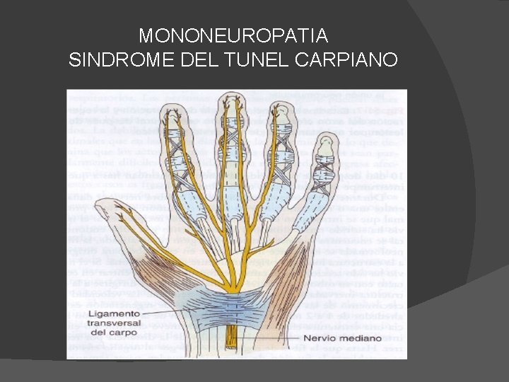 MONONEUROPATIA SINDROME DEL TUNEL CARPIANO 