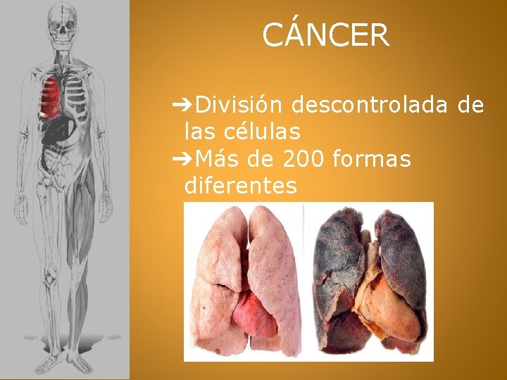 CÁNCER ➔División descontrolada de las células ➔Más de 200 formas diferentes 