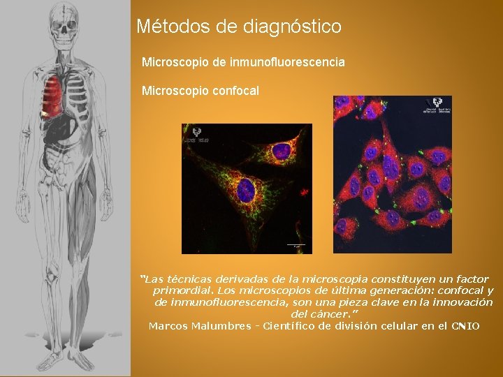 Métodos de diagnóstico Microscopio de inmunofluorescencia Microscopio confocal “Las técnicas derivadas de la microscopía