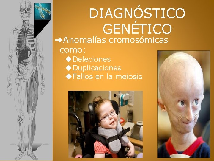 DIAGNÓSTICO GENÉTICO ➔Anomalías cromosómicas como: ◆Deleciones ◆Duplicaciones ◆Fallos en la meiosis 