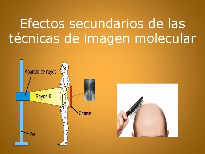 Efectos secundarios de las técnicas de imagen molecular 