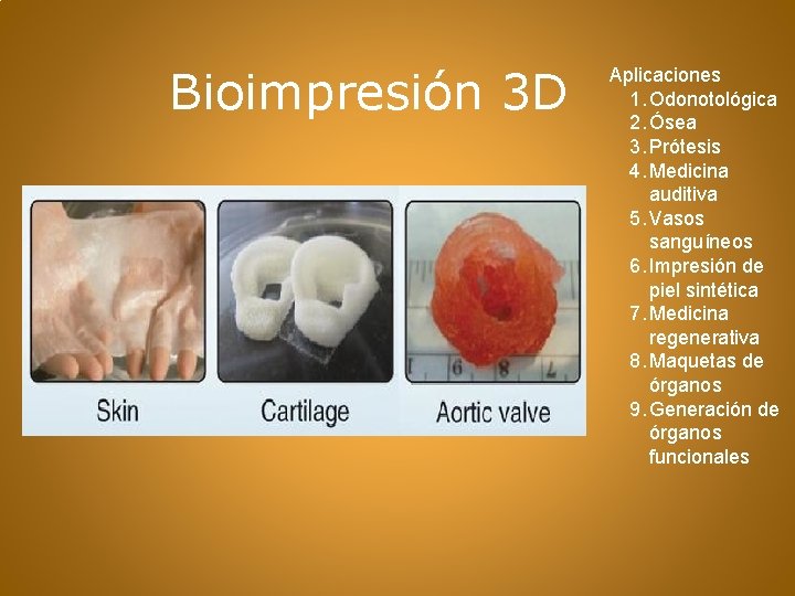 Bioimpresión 3 D Aplicaciones 1. Odonotológica 2. Ósea 3. Prótesis 4. Medicina auditiva 5.