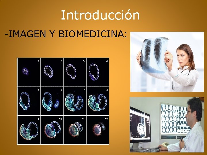 Introducción -IMAGEN Y BIOMEDICINA: 