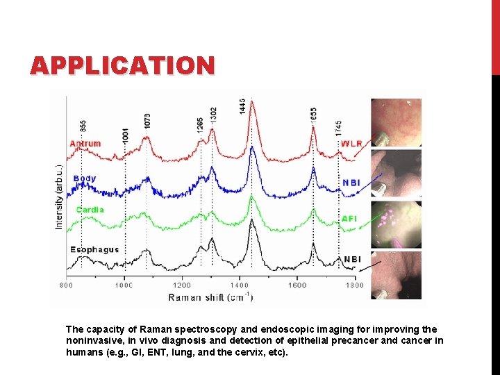 APPLICATION The capacity of Raman spectroscopy and endoscopic imaging for improving the noninvasive, in