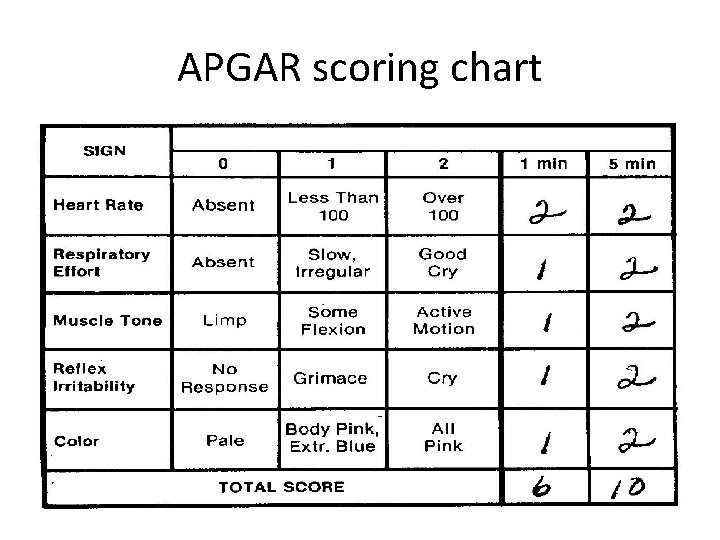 APGAR scoring chart 