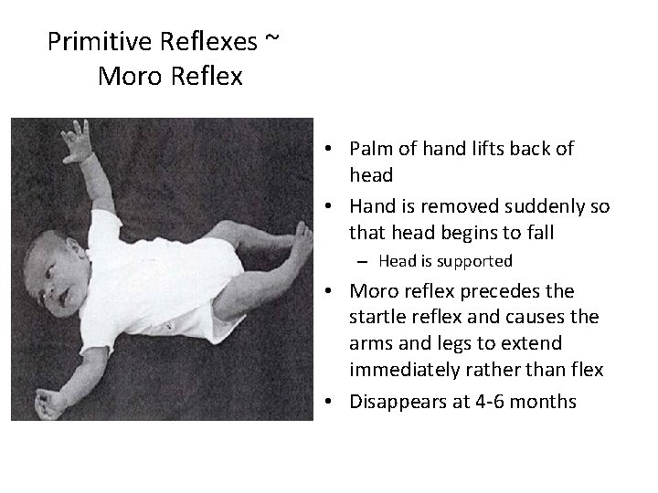 Primitive Reflexes ~ Moro Reflex • Palm of hand lifts back of head •