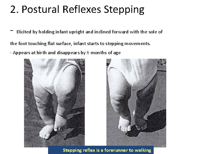 2. Postural Reflexes Stepping - Elicited by holding infant upright and inclined forward with