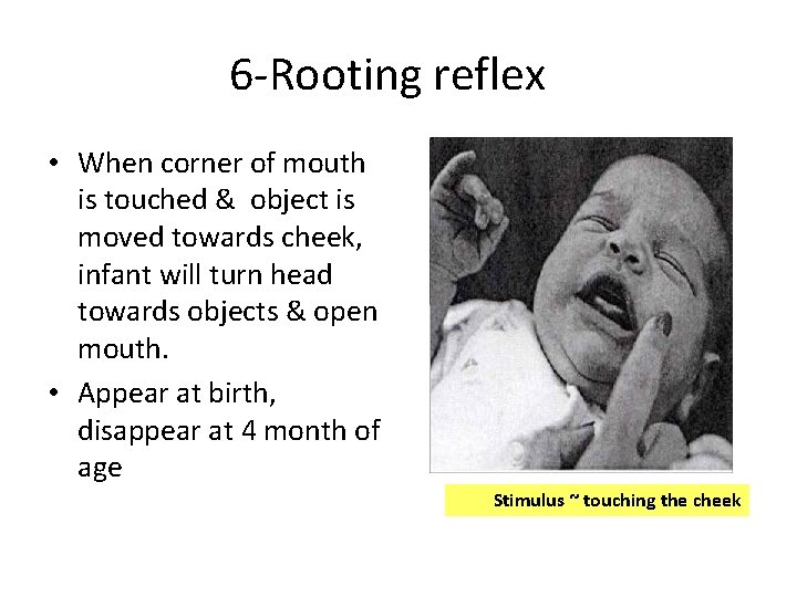 6 -Rooting reflex • When corner of mouth is touched & object is moved