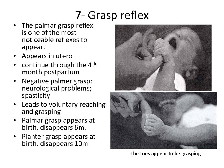 7 - Grasp reflex • The palmar grasp reflex is one of the most