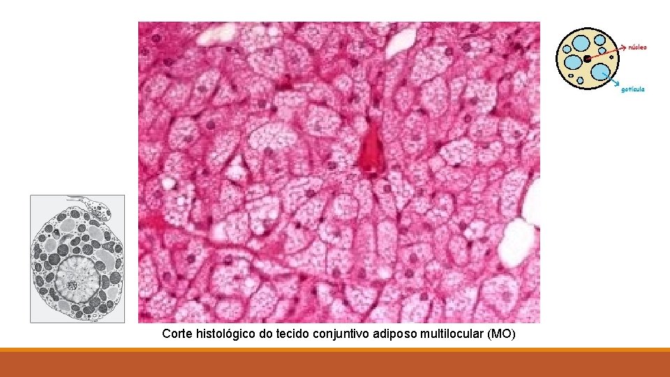 Corte histológico do tecido conjuntivo adiposo multilocular (MO) 
