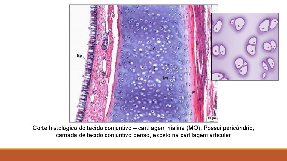 Corte histológico do tecido conjuntivo – cartilagem hialina (MO). Possui pericôndrio, camada de tecido