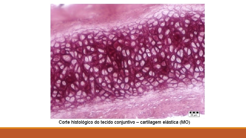 Corte histológico do tecido conjuntivo – cartilagem elástica (MO) 