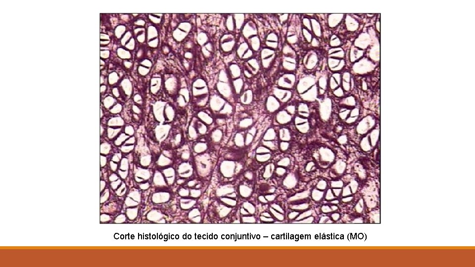 Corte histológico do tecido conjuntivo – cartilagem elástica (MO) 