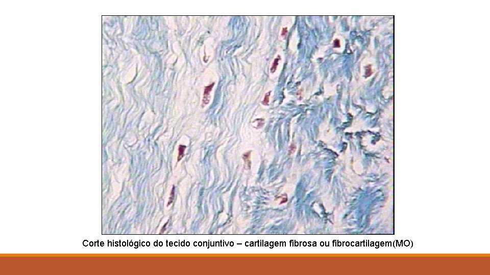 Corte histológico do tecido conjuntivo – cartilagem fibrosa ou fibrocartilagem(MO) 