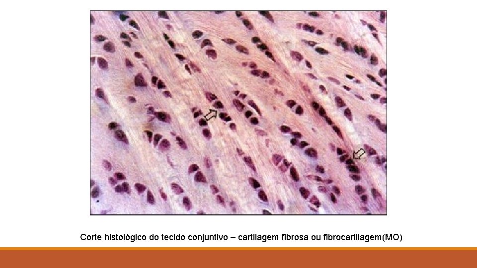Corte histológico do tecido conjuntivo – cartilagem fibrosa ou fibrocartilagem(MO) 