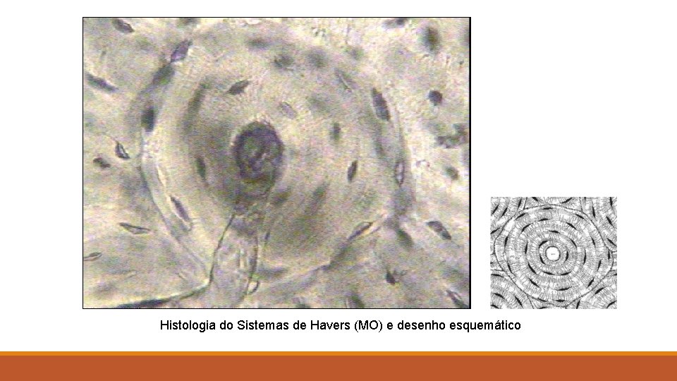 Histologia do Sistemas de Havers (MO) e desenho esquemático 