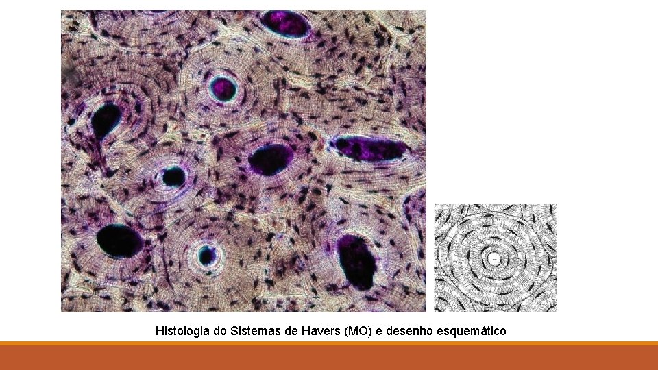 Histologia do Sistemas de Havers (MO) e desenho esquemático 
