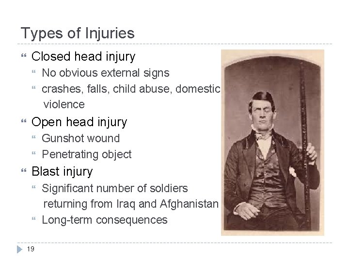 Types of Injuries Closed head injury Open head injury No obvious external signs crashes,