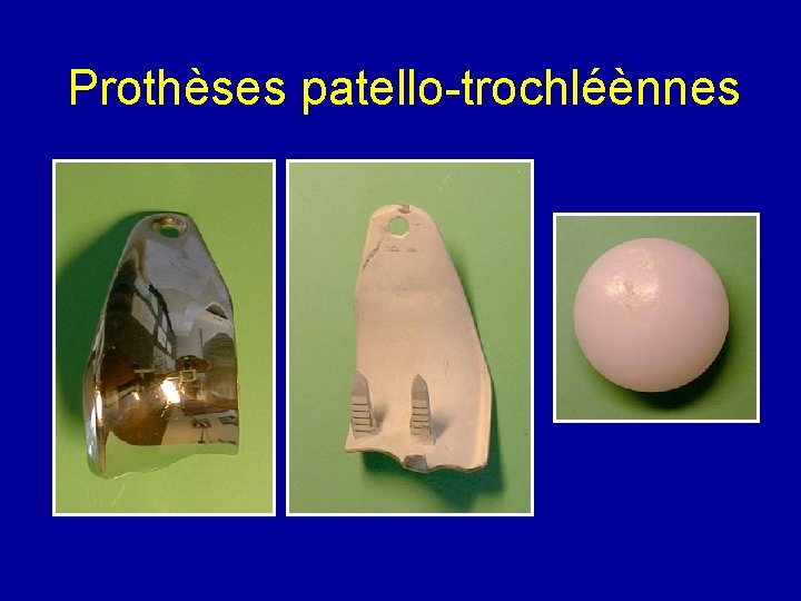 Prothèses patello-trochléènnes 