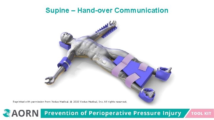 Supine – Hand-over Communication Reprinted with permission from Xodus Medical. © 2020 Xodus Medical,