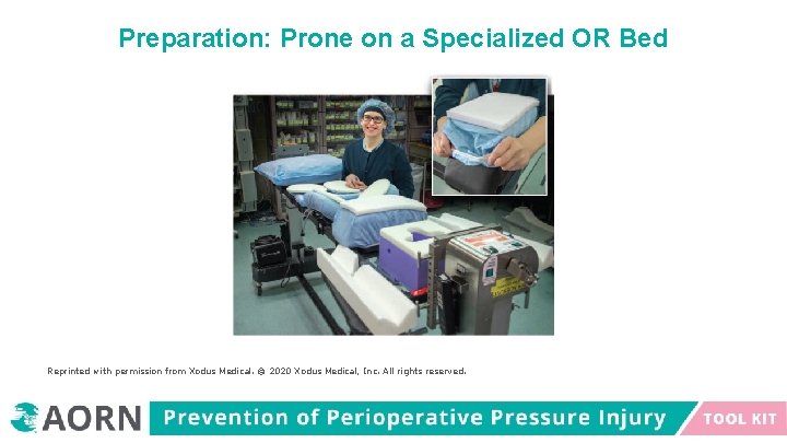 Preparation: Prone on a Specialized OR Bed Reprinted with permission from Xodus Medical. ©
