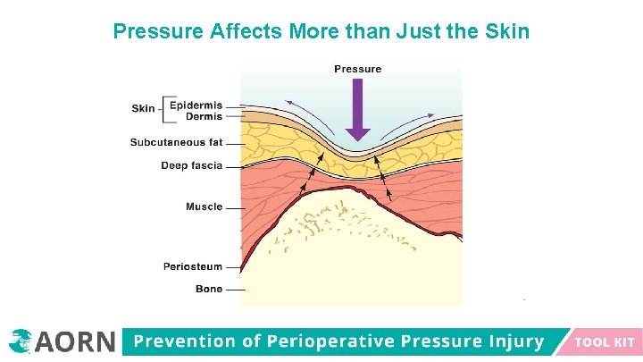 Pressure Affects More than Just the Skin 