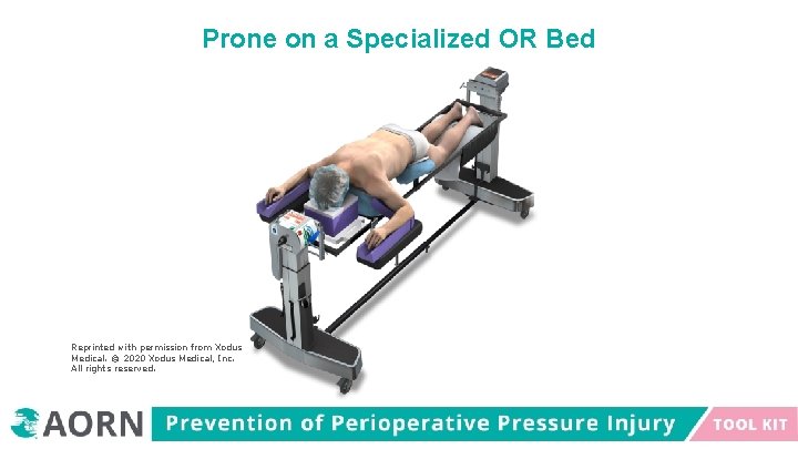 Prone on a Specialized OR Bed Reprinted with permission from Xodus Medical. © 2020