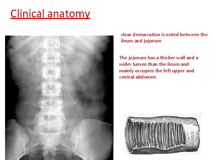 ` Clinical anatomy clear demarcation is noted between the ileum and jejunum The jejunum