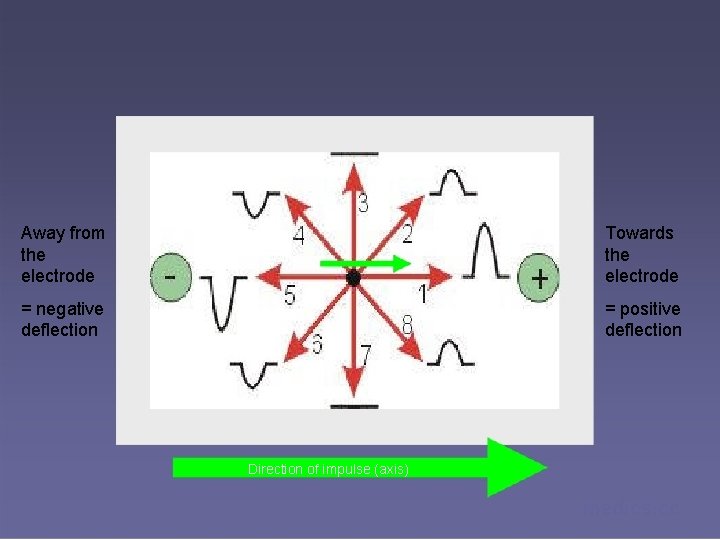 Away from the electrode Towards the electrode = negative deflection = positive deflection Direction