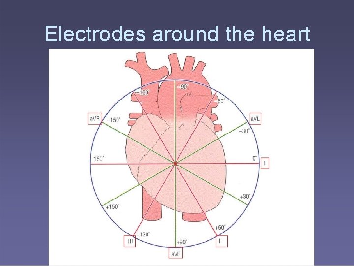 Electrodes around the heart 