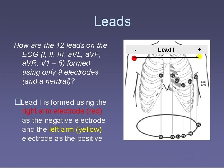 Leads How are the 12 leads on the ECG (I, III, a. VL, a.